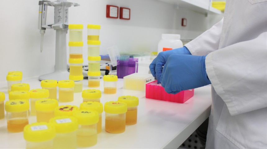 Urine samples in a lab